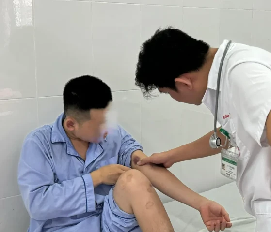 Nam thanh niên nghi mắc giun rồng và dương tính với nhiều loại ký sinh trùng