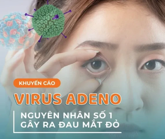 Virus Adeno: Nguyên nhân số 1 gây ra dịch đau mắt đỏ trong giai đoạn cuối mùa xuân