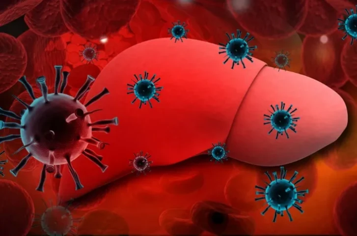 Viêm gan vi rút (Viral hepatitis)