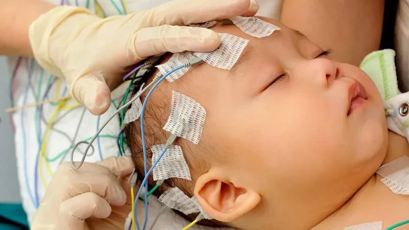 Đo điện não đồ để tìm ra những bệnh lý gì?