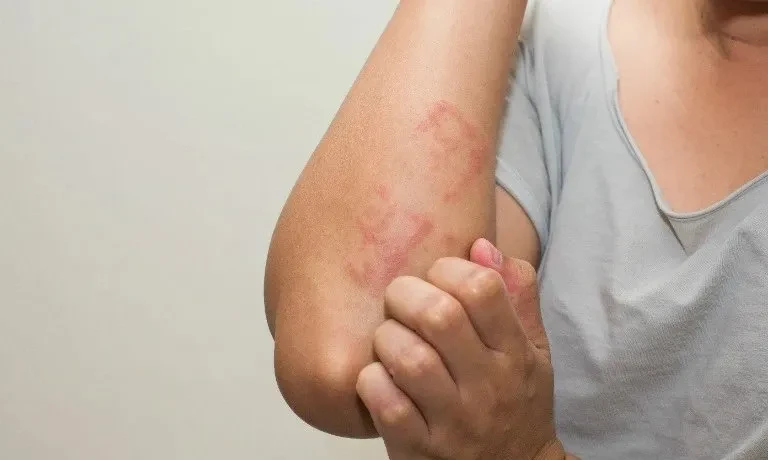 Ăn uống không hợp vệ sinh một người bị nhiễm ấu trùng sán dây lợn