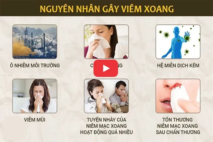 Cách điều trị bệnh viêm xoang