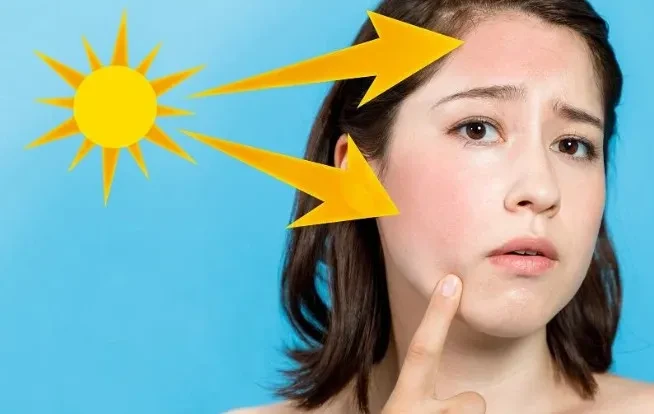 Những cách đơn giản giúp bảo vệ làn da khỏi nắng nóng mùa hè