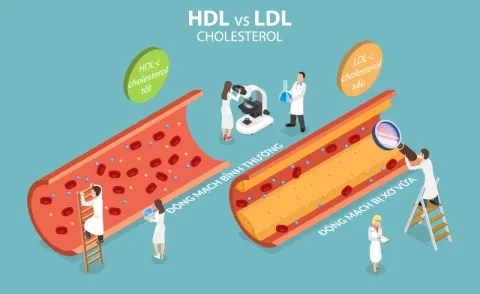 Rối loạn lipid máu: nguyên nhân, biến chứng, điều trị và phòng ngừa