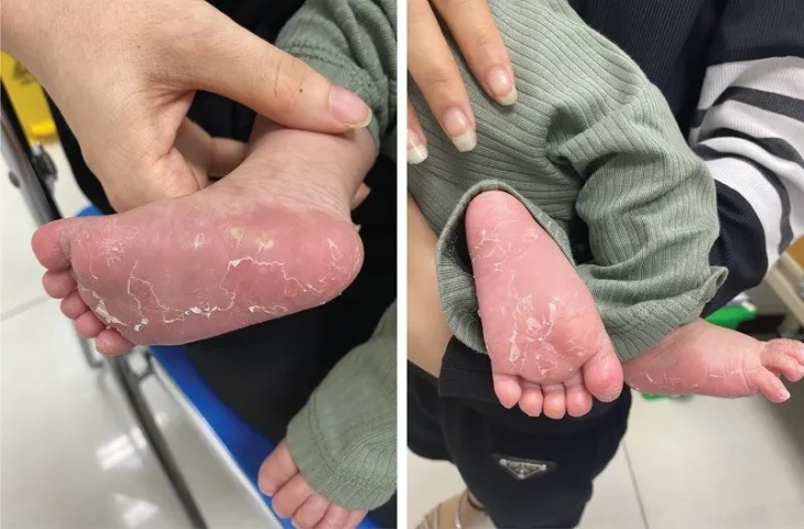 Chuyên gia khuyến cáo cách phòng bệnh lây truyền qua đường tình dục