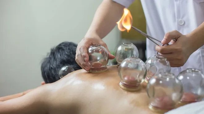Lợi ích của trị liệu giác hơi