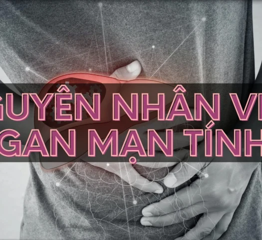 Nguyên nhân viên gan mạn tính