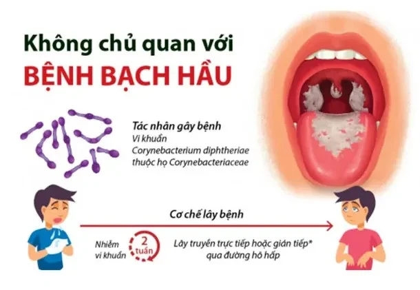 Chuyên gia khuyến cáo cách phòng tránh bệnh bạch hầu
