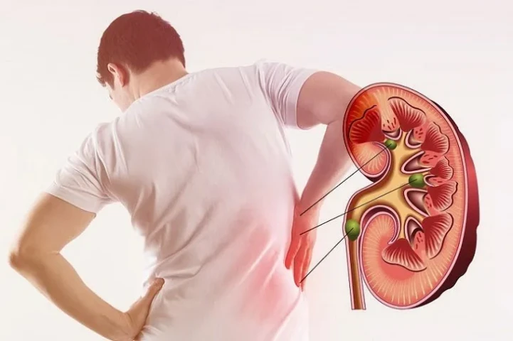 Ý nghĩa của các xét nghiệm hóa sinh đánh giá chức năng thận