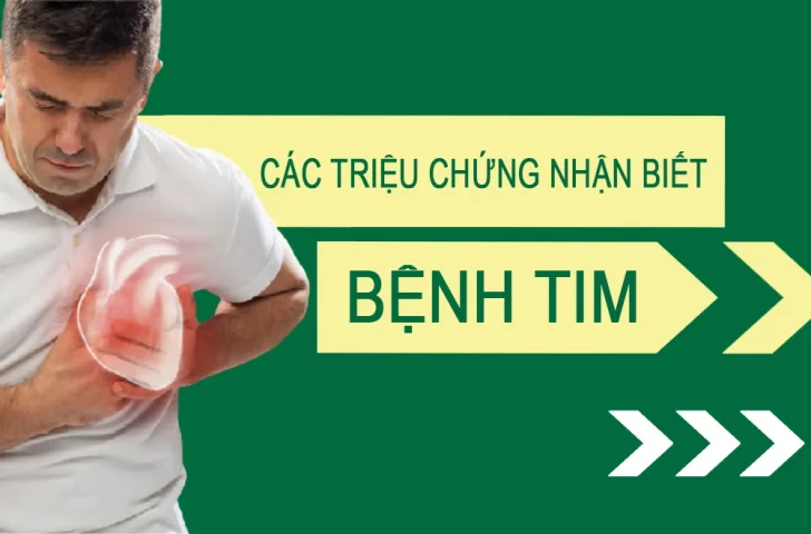 Các triệu chứng nhận biết bệnh tim