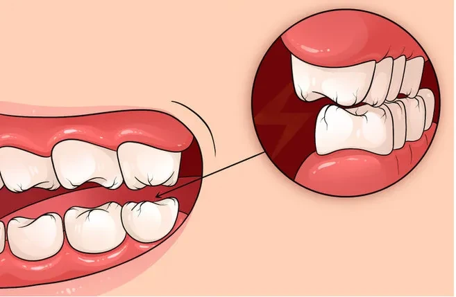 7 dấu hiệu trên cơ thể cho thấy bạn đang căng thẳng