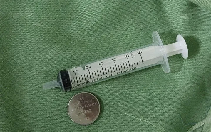 Cảnh báo dị vật đường tiêu hóa gây tổn thương nghiêm trọng
