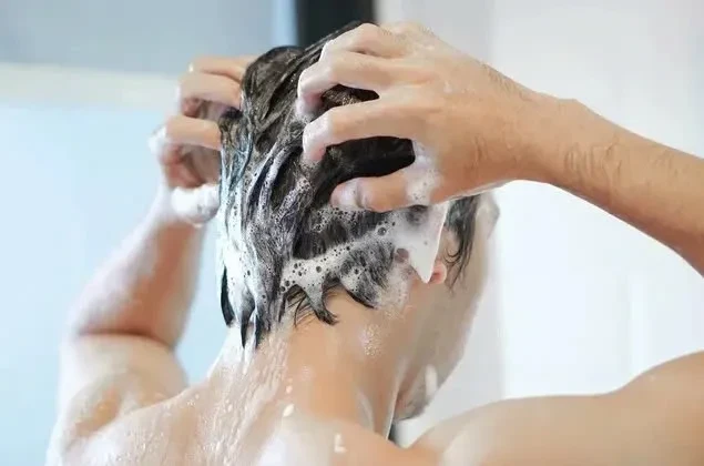 Triệu chứng, nguyên nhân và cách điều trị bệnh vẩy nến da đầu