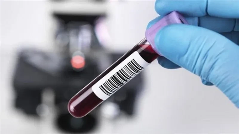 Nồng độ ethanol trong máu và tai nạn giao thông