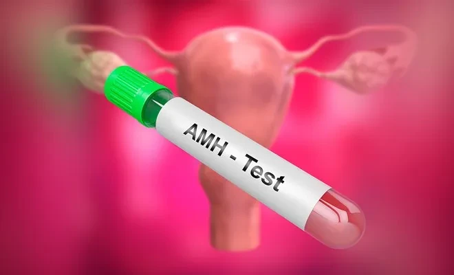 Ý nghĩa của xét nghiệm AMH?