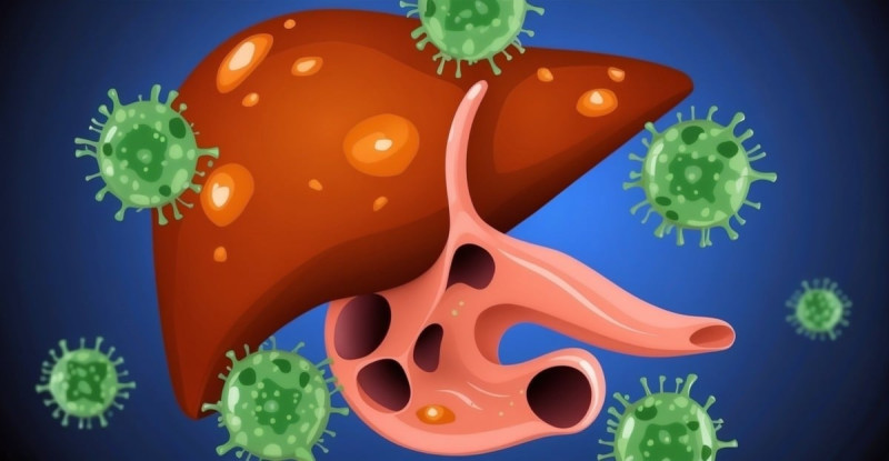 Tìm hiểu về Viêm gan virus C