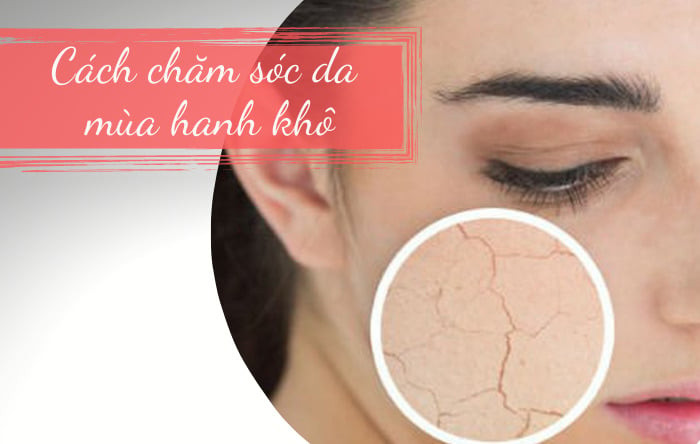 Chăm sóc da đúng cách trong mùa hanh khô