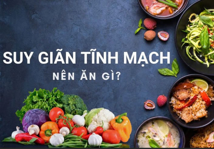 Chế độ ăn uống và thói quen lành mạnh giúp nam giới cải thiện giãn tĩnh mạch tinh