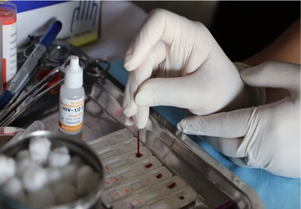 Xét Nghiệm HIV Sớm: Bước quan trọng kiểm soát và ngăn ngừa lây nhiễm