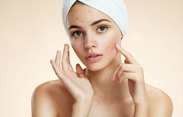Đường ảnh hưởng đến làn da như thế nào?