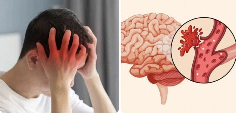 Cảnh báo các yếu tố gây đột quỵ mùa lạnh