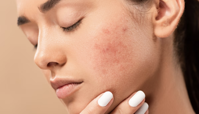 9 sản phẩm bạn tuyệt đối không nên thoa lên mặt, tránh gây hư tổn cho da