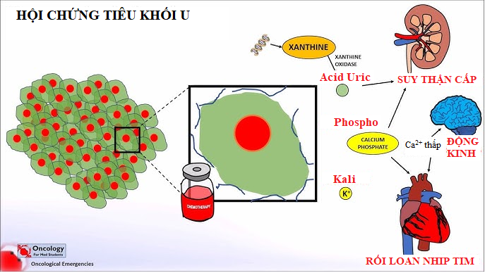Hội chứng tiêu khối u