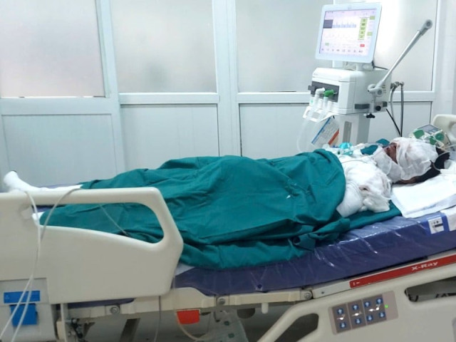 Cấp cứu 3 người bị bỏng nặng do nổ