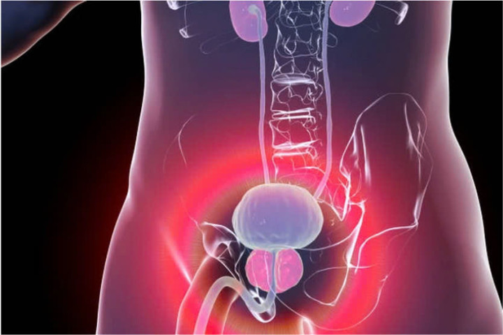 Đột Phá Trong Điều Trị: Thuốc Mới Kéo Dài Sự Sống Cho Bệnh Nhân Ung Thư Tuyến Tiền Liệt