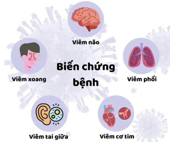 Các biến chứng của bệnh cúm