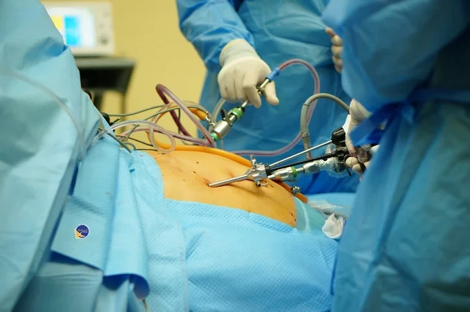 Ca phẫu thuật nội soi cắt gan trái đầu tiên tại Tây Ninh