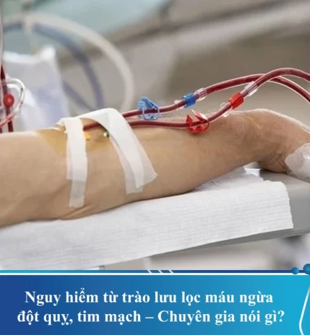 Chuyên gia cảnh báo mối nguy hiểm từ “trào lưu” lọc máu ngừa đột quỵ, tim mạch