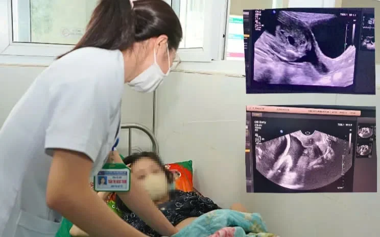 Nghệ An: Khâu eo cổ tử cung giúp giữ thai 22 tuần cho sản phụ
