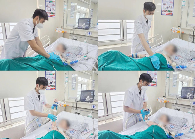 Phục hồi chức năng hô hấp cho người bệnh viêm phổi do thở máy