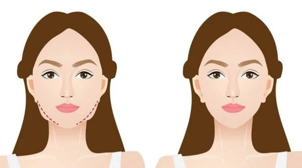8 mẹo hiệu quả để giảm mỡ mặt