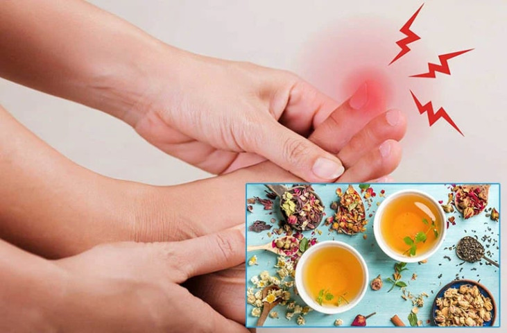 Bài thuốc hỗ trợ điều trị bệnh gout