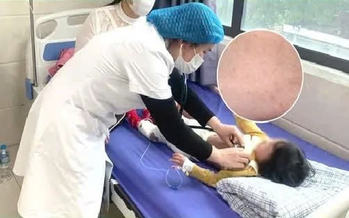 Phú Thọ: Cấp cứu thành công bệnh nhân 38 tuổi bị hen phế quản ác tính nguy kịch