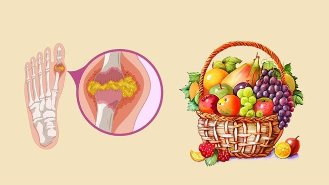 Chống lại axit uric cao nhờ những loại trái cây quen thuộc giàu vitamin B12