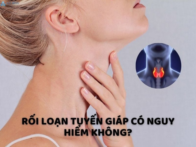 Rối loạn tuyến giáp và những cơn đau đầu không ngờ tới