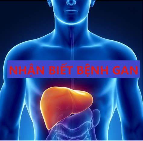 Những dấu hiệu cho thấy gan của bạn đang bị quá tải