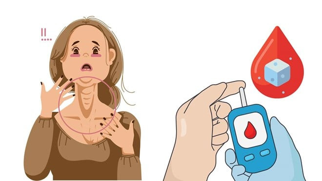 Dấu hiệu ở cổ báo hiệu đường huyết vượt quá giới hạn