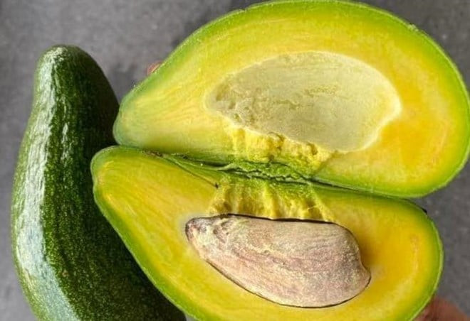 Người suy thận nên tránh ăn loại quả quen thuộc này trước khi đi ngủ