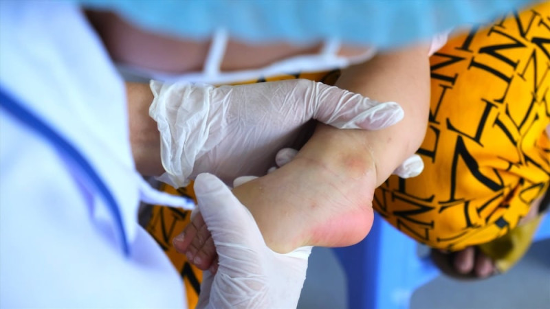 Sốt xuất huyết gia tăng, ngành y tế ĐBSCL cảnh báo nguy cơ bùng phát