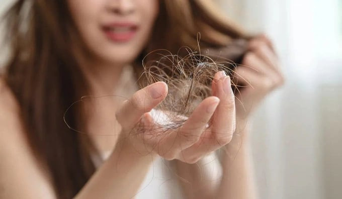 5 cách ngăn rụng tóc ở phụ nữ