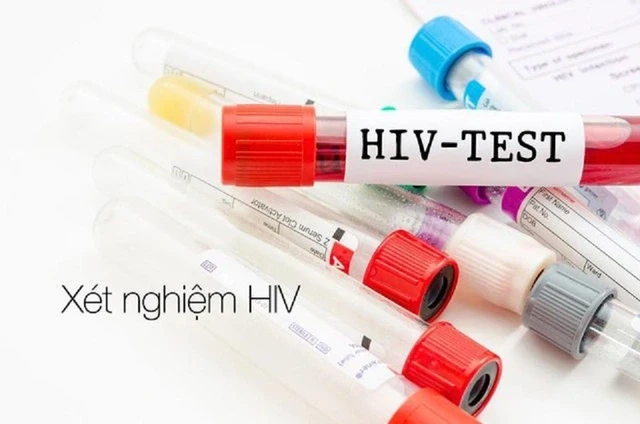 Khánh Hòa báo động gia tăng nhiễm HIV trong nhóm nam quan hệ đồng giới
