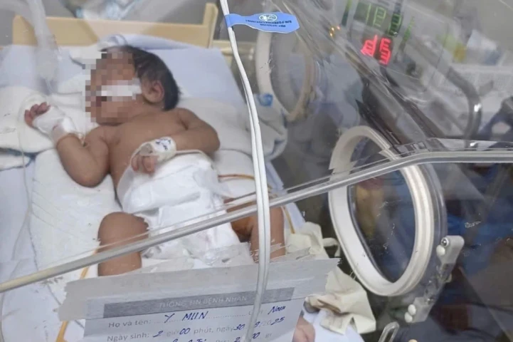 Bé sơ sinh 5 ngày tuổi suýt mất mạng vì mẹ cho ăn cơm