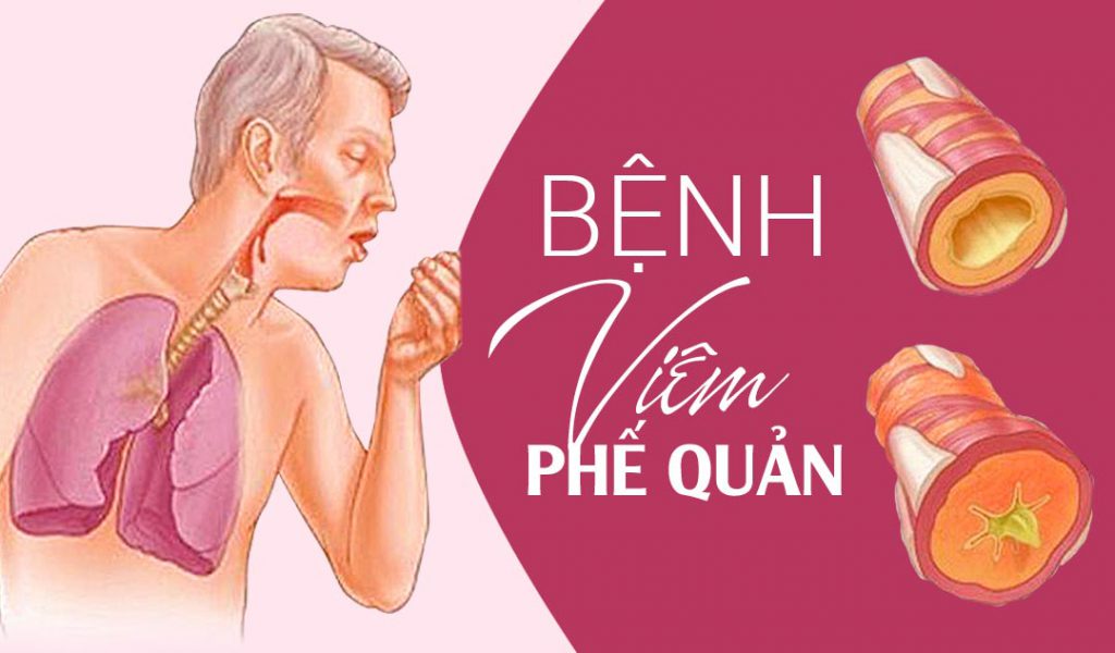 Viêm Phế Quản