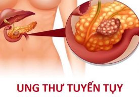 Ung Thu Tuyen Tuy