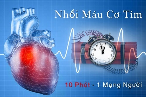 Nhồi Máu Cơ Tim Cấp