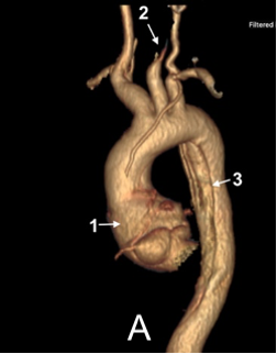 Trước Mổ 1